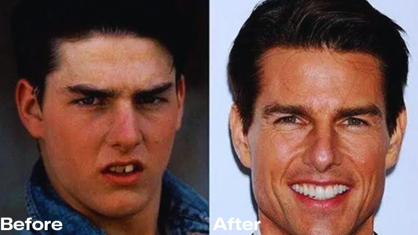 Tom Cruise Teeth